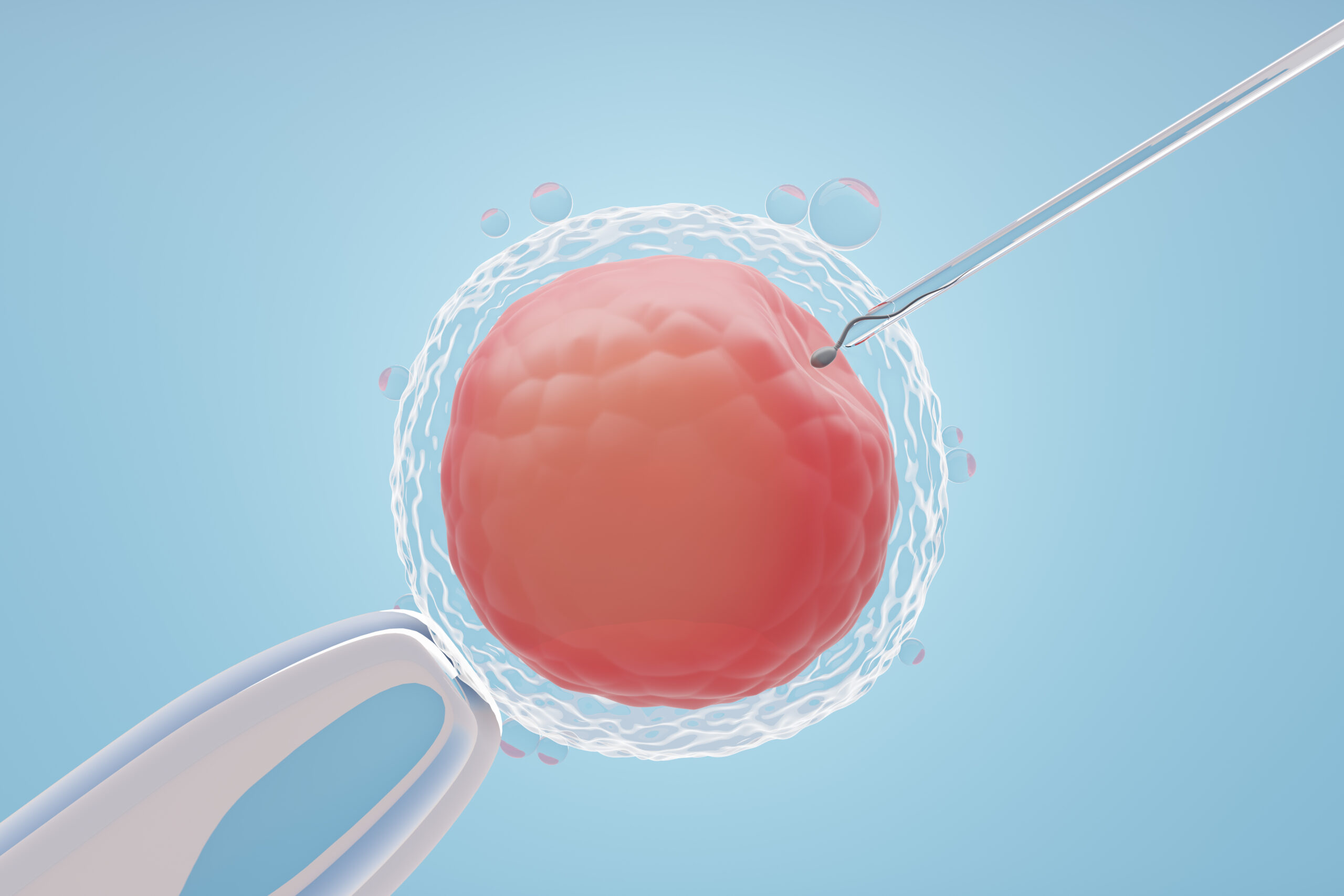 Εξωσωματική στην Αθήνα – διαδικασία IVF με μικρογονιμοποίηση