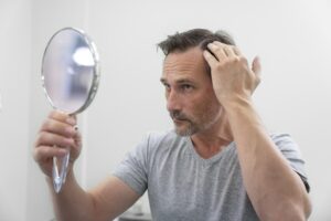 Τριχόπτωση: Θεραπεία ή μεταμόσχευση;